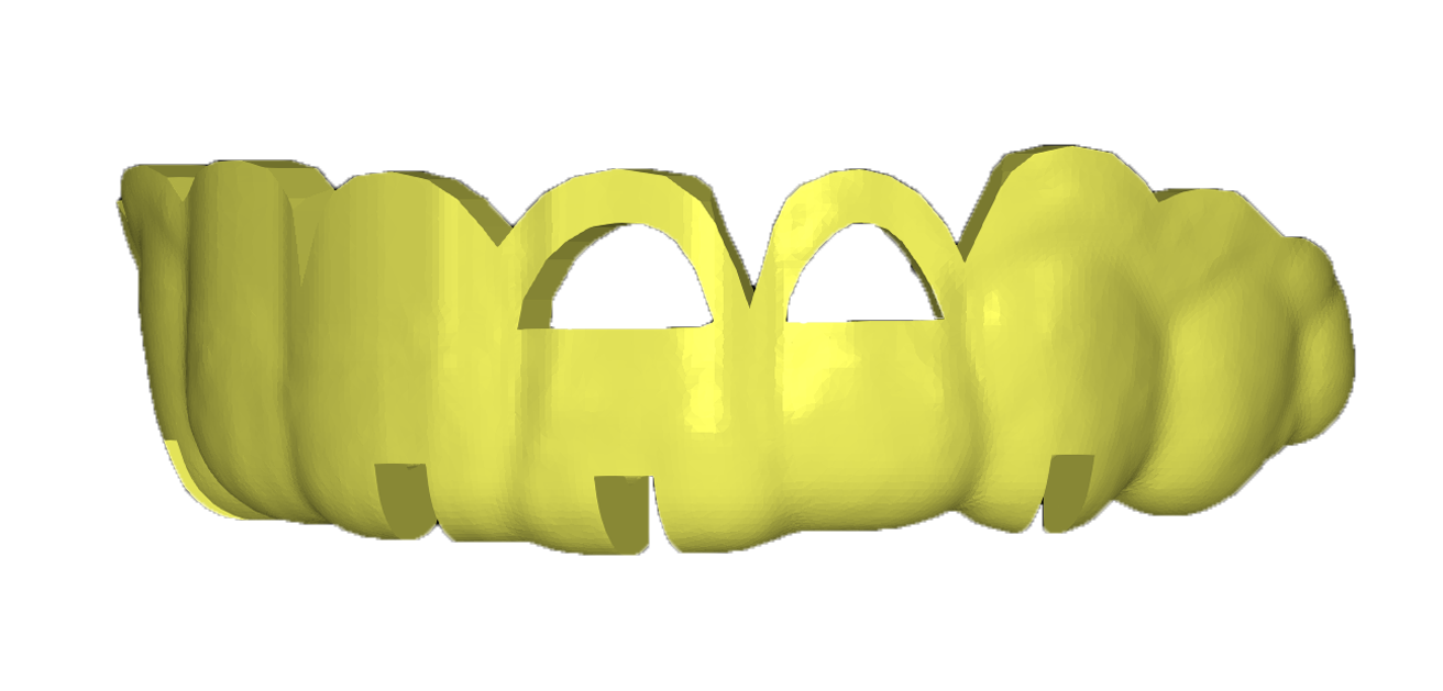 ggweb