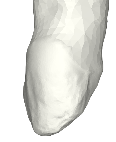 112