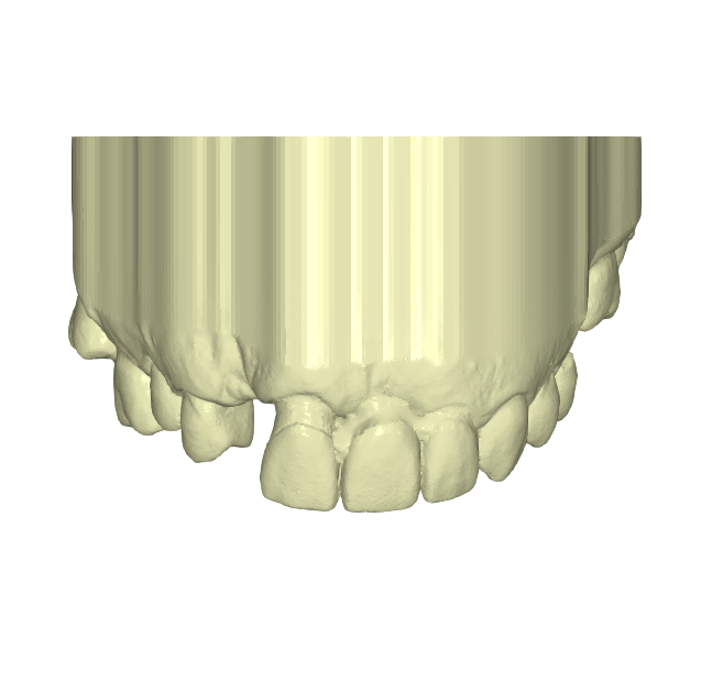118